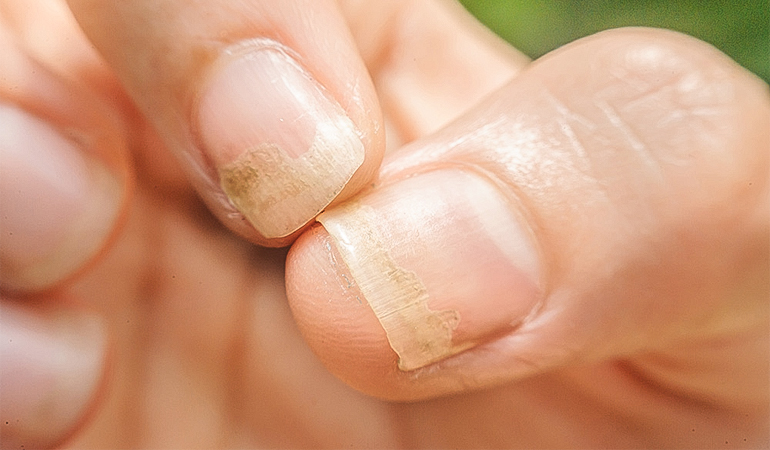 Khám bệnh da liễu